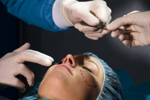 Facelift Surgery Saratoga, CA - Woman receiving Plastic Operation