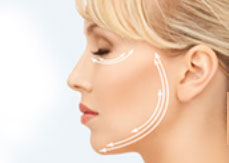 Face Lift–Rhytidectomy