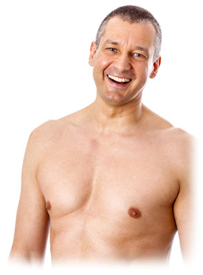 gynecomastia